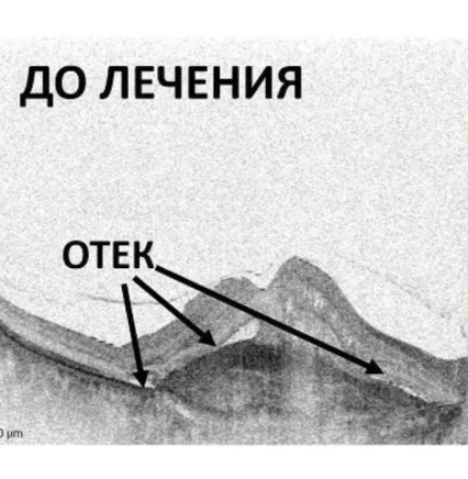 Офтальмологическая клиника Центр Ока Киев