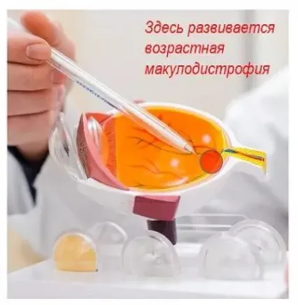Де розвивається вікова макулодистрофія