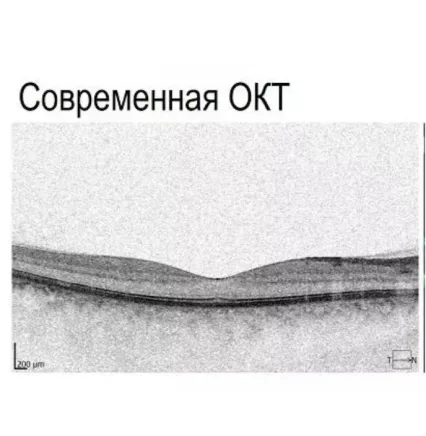 Сучасний приклад ОКТ
