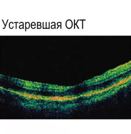 Застарівший приклад ОКТ