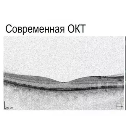 Сучасний приклад ОКТ